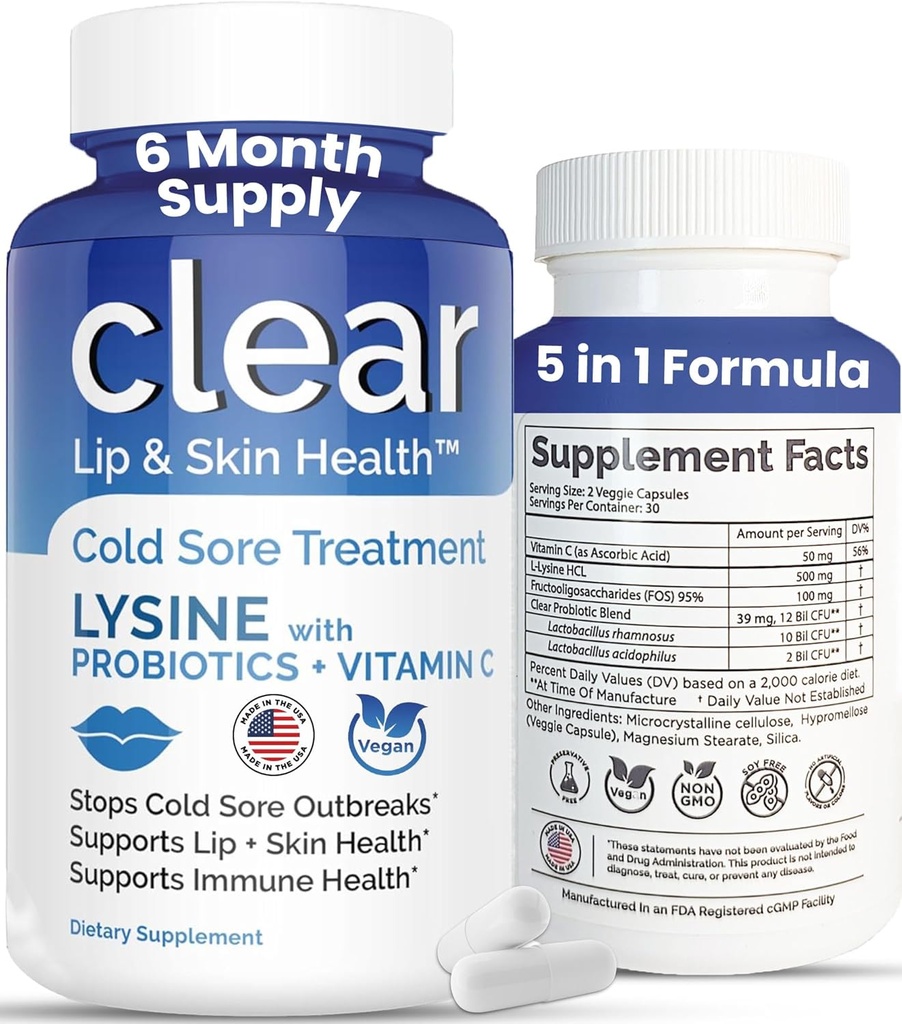 Lysine Cold Sore Treatment for Lips – με Lactobacillus Rhamnosus, Acidophilus και βιταμίνη C – Cold Sore Supplement for Lip & Skin Health, Immune Support & Prevention – 360 Κάψουλες