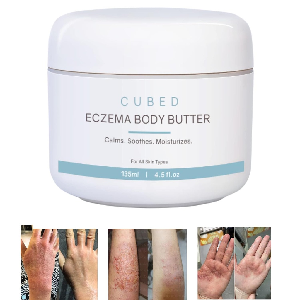 Cubed 4. 5 oz Eczema Κρέμα για Ενήλικες, Eczema Relief, Eczema Θεραπεία, Ενυδατώστε Ξηρό Ερεθισμένο Δέρμα, Έξυπνη Λοσιόν για Επίκαιρα Στεροειδή Συμπτώματα απόσυρσης, Ψωρίαση & Rosacea, Eczema, Δερματίτιδα