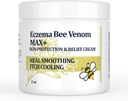 Κρέμα υψηλής αντοχής Bee Venom, Dyshidrotic Eczema Αλοιφή, Εξάνθημα θερμότητας, φαγούρα, Έκζεμα, Ψωρίαση, Πόδι, Στομάχι, Πόδι, Χέρι, Ερεθισμένο Δέρμα, Όλα Ηλικία Φροντίδα