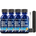 4Pcs Θεραπεία με μυκητιασικά των ποδιών, 25% Ανδεκυλενικό οξύ, Θεραπεία με μύκητες των νυχιών για θεραπείες με μύκητες των ποδιών (2 FL OZ)