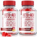 NutraRize (Συσκευασία 2 KetoKandies Keto+ACV Gummies για απώλεια βάρους, συμπλήρωμα μέγιστης αντοχής, Keto Kandies Κριτικές (120 Gummies)