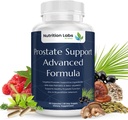 Prostate Health Support βοτανικό συμπλήρωμα για τους άνδρες με βήτα σιτοστερόλη, σελήνιο, Pygeum και Saw Palmetto εκχύλισμα για υποστήριξη και συχνή ούρηση Prostate - 90 CT