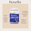 Acne Clear - Acne Pills Clear Skin - Acne Treatment - Cleanse & Detoxify - Αντι-Ακνη Συμπληρώματα για άνδρες, γυναίκες & εφήβους – Ορμονικά και κυστική χάπια ακμής - 100% Φυσικό συμπλήρωμα βοτάνων