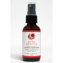 Corazon Therapeutics Burn Rescue Calendula Spray, Natural Soothing Relief for Minor Burns, 2 oz