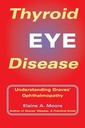 Thyroid Eye Disease: Understanding Graves' Ophthalmopathy