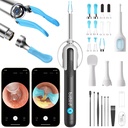 BEBIRD R1 Ultra Ear Wax Removal Tweezers: 1296P HD Ear Camera Cleaner,Black | FSA/HSA Painless Tweezers & Visual Dropper Tool, Help Remove Various Earwax with 11 Tips, 3 Silicone Check kits for Home Use