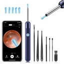 Loyker Ear Wax Removal, Ear Cleaner with 1080P Camera, Otoscope with Light, Ear Wax Removal Kit with 6 Ear Pick, Ear Camera for iPhone, iPad, Android Phones (Blue)