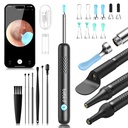BEBIRD R1 Ear Wax Removal Tool:Ear Cleaner with HD Ear Camera FSA&HSA | Solve earwax buildup Removal - 10 replacement tips for various needs - HD visual with led & silicone 3-piece set ensures safe
